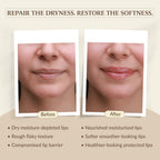 LipShield Rx