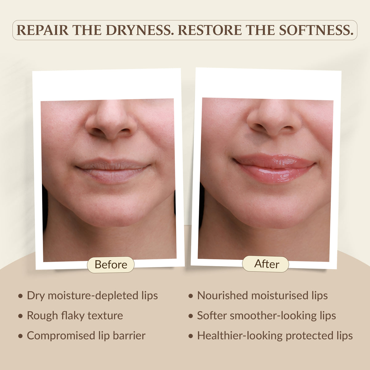 LipShield Rx